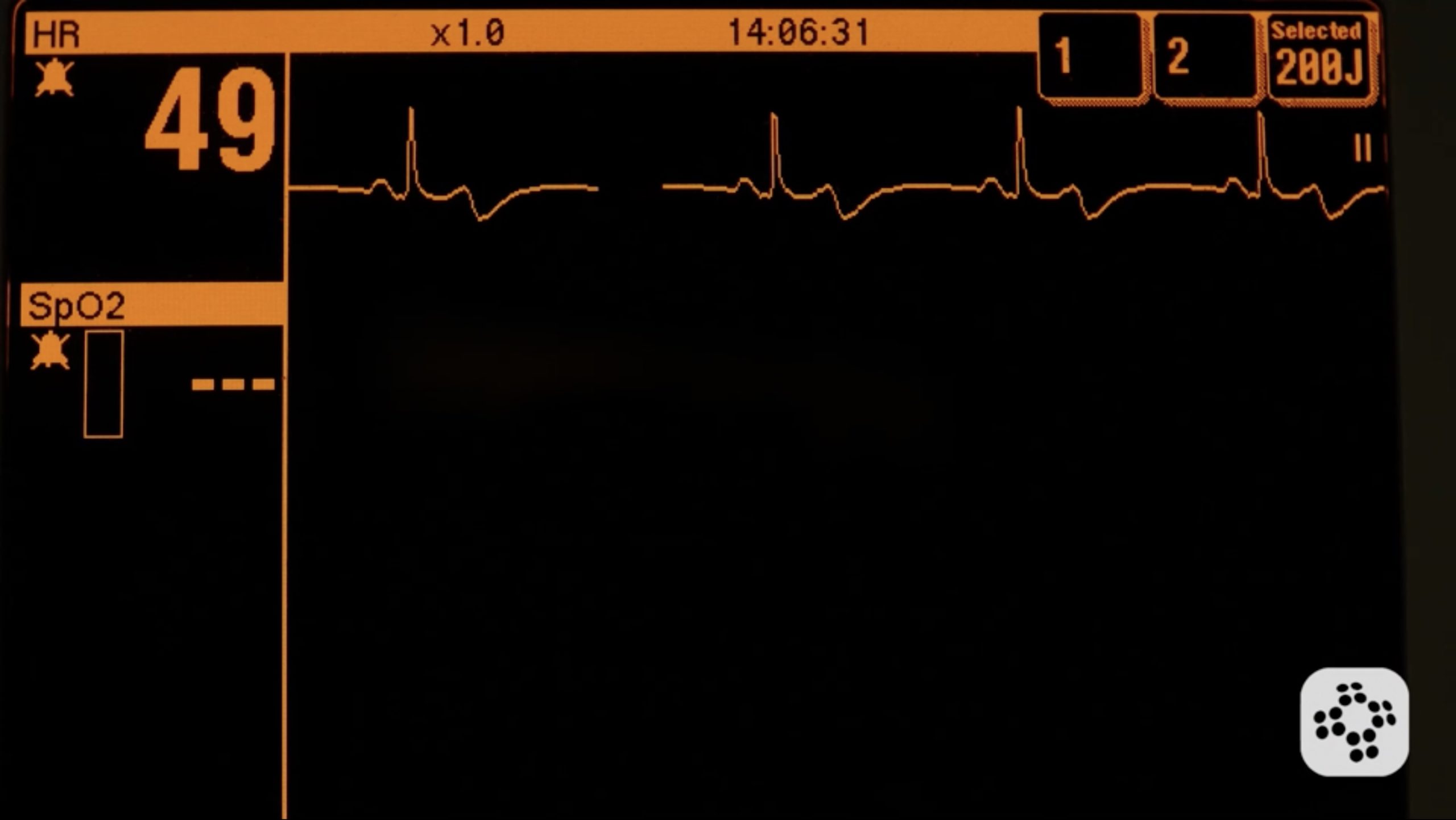 acls-screen-4